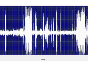 ultrasound