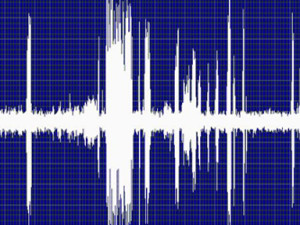 Ultrasound Inspections